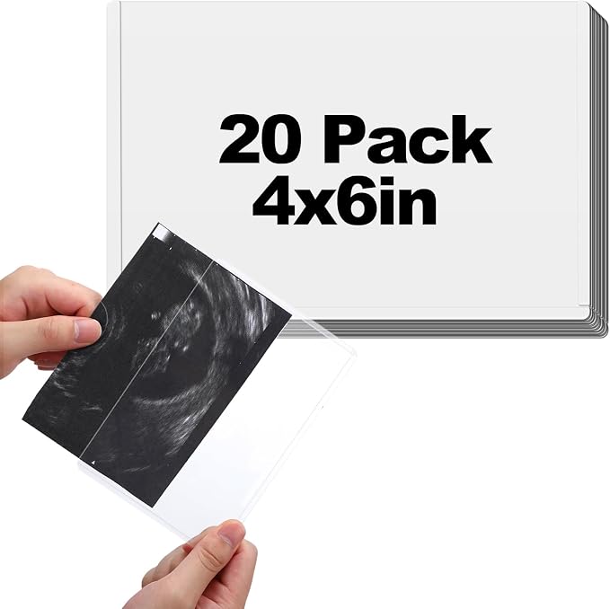 Easy-Slide Photocard Sleeves Photo Protector for 4x6in Ultrasound Pictures | Keep Baby Sonogram Picture/Special Memories Safe, Pregnancy Journal Must Haves, Pregnancy Gifts for Expecting Mom, 20 Pack by Biubee