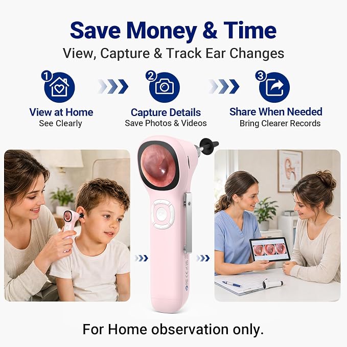 Otoscope with Light, No App Needed, HD Screen, Ear Scope Camera for Family | Ear Camera with Earwax Removal Kit for Home Cleaning Checking, Photo & Video, 3.9mm Lens, 8GB Card, LED Light, Type-C Port - Image 6