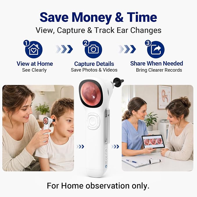 Otoscope with Light, No App Needed, HD Screen, Ear Scope Camera for Family | Ear Camera with Earwax Removal Kit for Home Cleaning Checking, Photo & Video, 3.9mm Lens, 8GB Card, LED Light, Type-C Port - Image 6