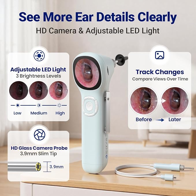 Otoscope with Light, No App Needed, HD Screen, Ear Scope Camera for Family | Ear Camera with Earwax Removal Kit for Home Cleaning Checking, Photo & Video, 3.9mm Lens, 8GB Card, LED Light, Type-C Port - Image 3