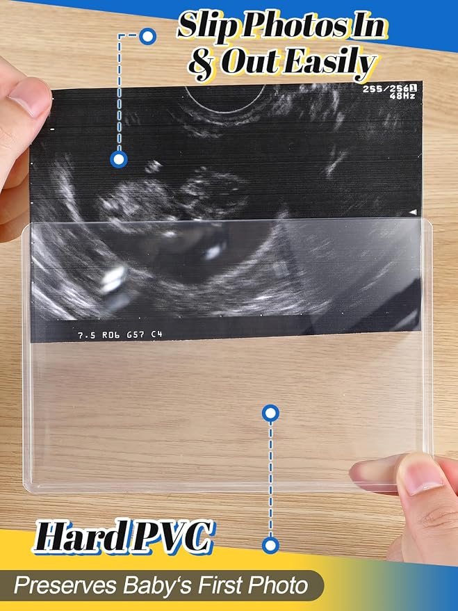 Easy-Slide Photocard Sleeves Photo Protector for 4x6in Ultrasound Pictures | Keep Baby Sonogram Picture/Special Memories Safe, Pregnancy Journal Must Haves, Pregnancy Gifts for Expecting Mom, 20 Pack - Image 3
