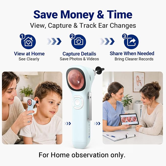Otoscope with Light, No App Needed, HD Screen, Ear Scope Camera for Family | Ear Camera with Earwax Removal Kit for Home Cleaning Checking, Photo & Video, 3.9mm Lens, 8GB Card, LED Light, Type-C Port - Image 6