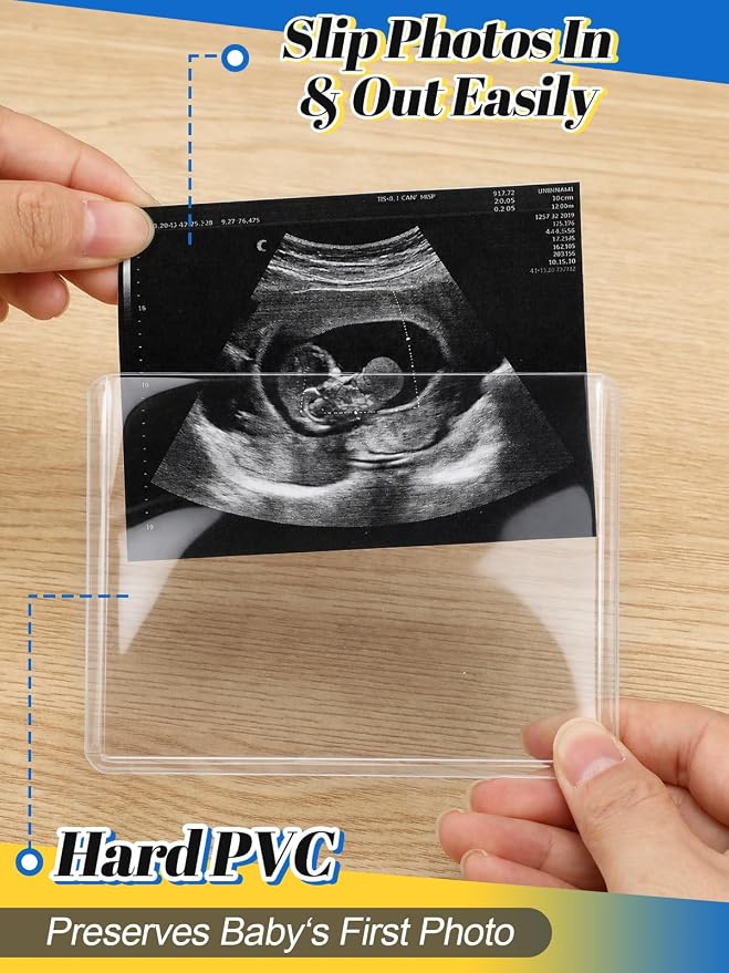 Easy-Slide Photocard Sleeves Photo Protector for 3x4in Ultrasound Pictures | Keep Baby Sonogram Picture/Special Memories Safe, Pregnancy Journal Must Haves, Pregnancy Gifts for Expecting Mom, 20 Pack - Image 3