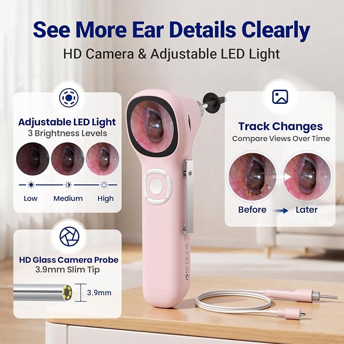 Otoscope with Light, No App Needed, HD Screen, Ear Scope Camera for Family | Ear Camera with Earwax Removal Kit for Home Cleaning Checking, Photo & Video, 3.9mm Lens, 8GB Card, LED Light, Type-C Port - Image 3