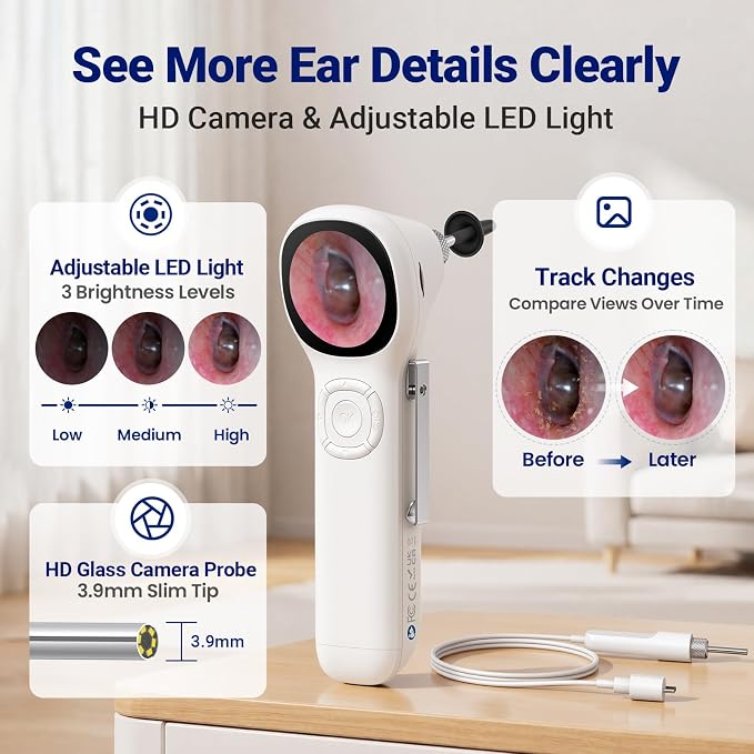 Otoscope with Light, No App Needed, HD Screen, Ear Scope Camera for Family | Ear Camera with Earwax Removal Kit for Home Cleaning Checking, Photo & Video, 3.9mm Lens, 8GB Card, LED Light, Type-C Port - Image 3