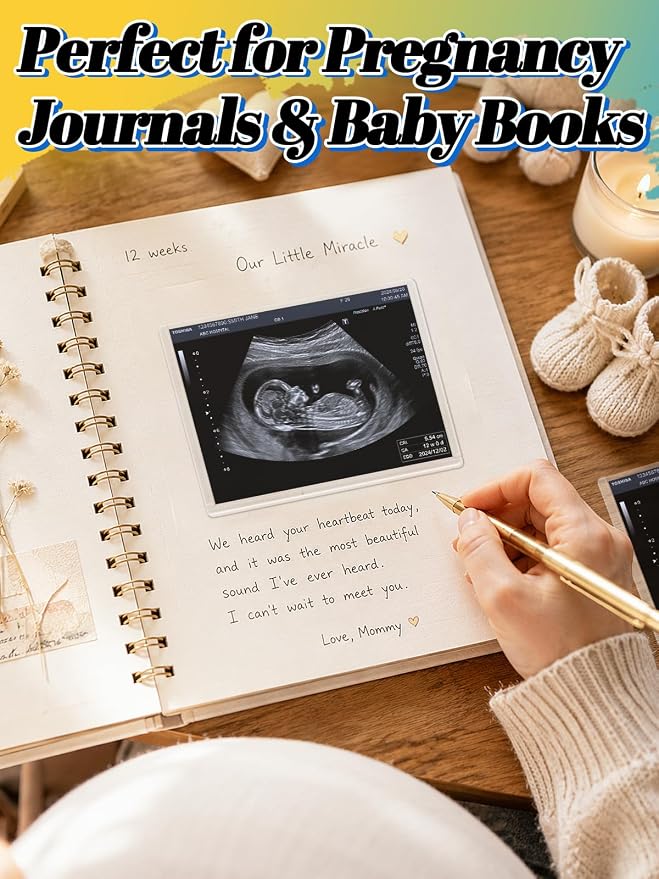Easy-Slide Photocard Sleeves Photo Protector for 3x4in Ultrasound Pictures | Keep Baby Sonogram Picture/Special Memories Safe, Pregnancy Journal Must Haves, Pregnancy Gifts for Expecting Mom, 20 Pack - Image 4
